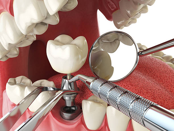 Best Emergency Root Canal Therapy in Marbury, AL